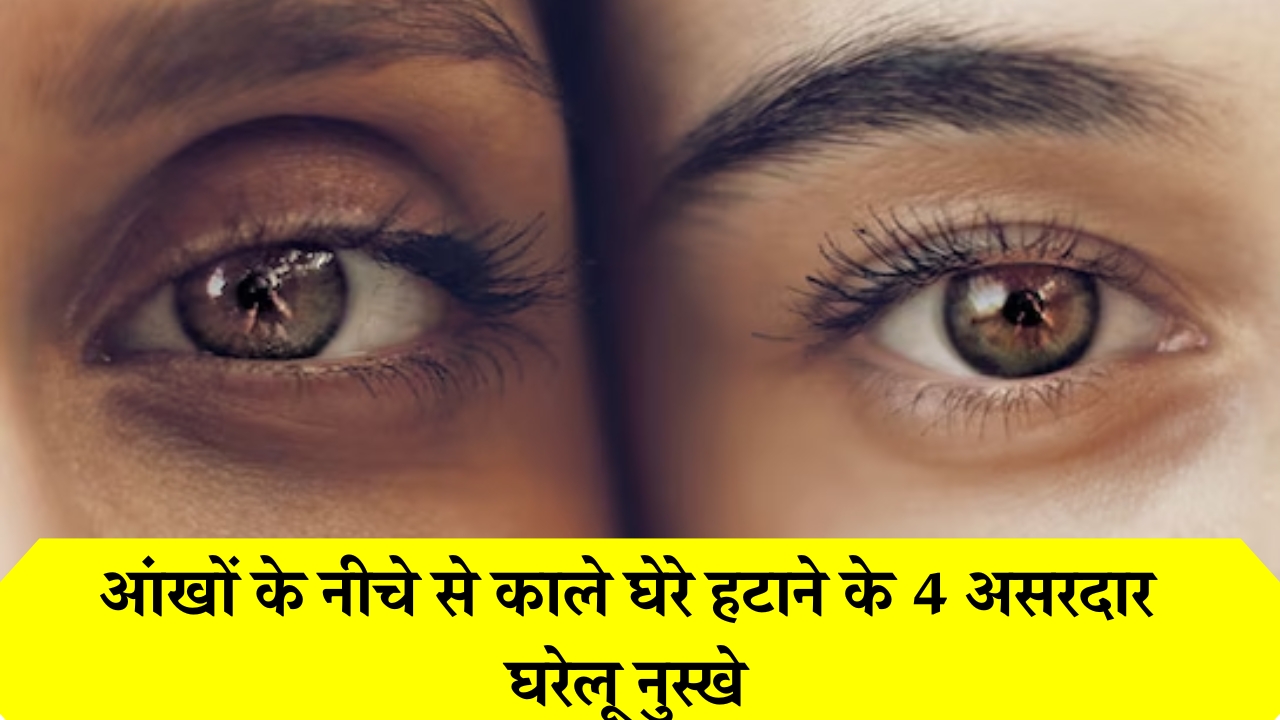 Dark-Circles-Removal-Home-Remedies
